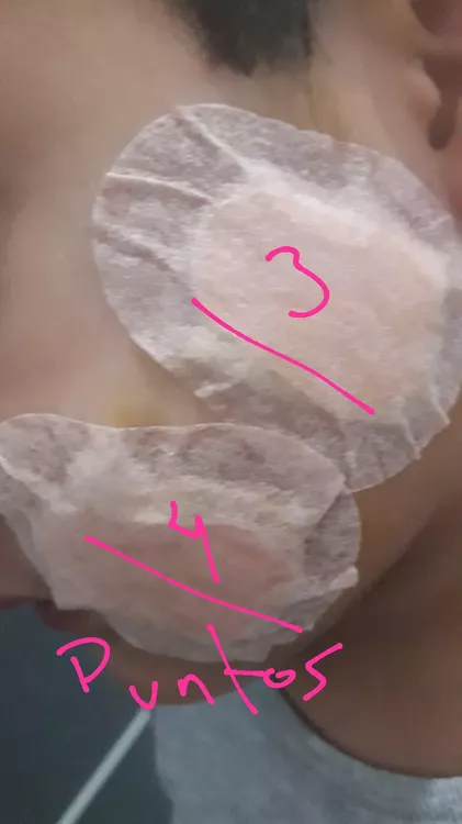 niño atacado por perro parque 2