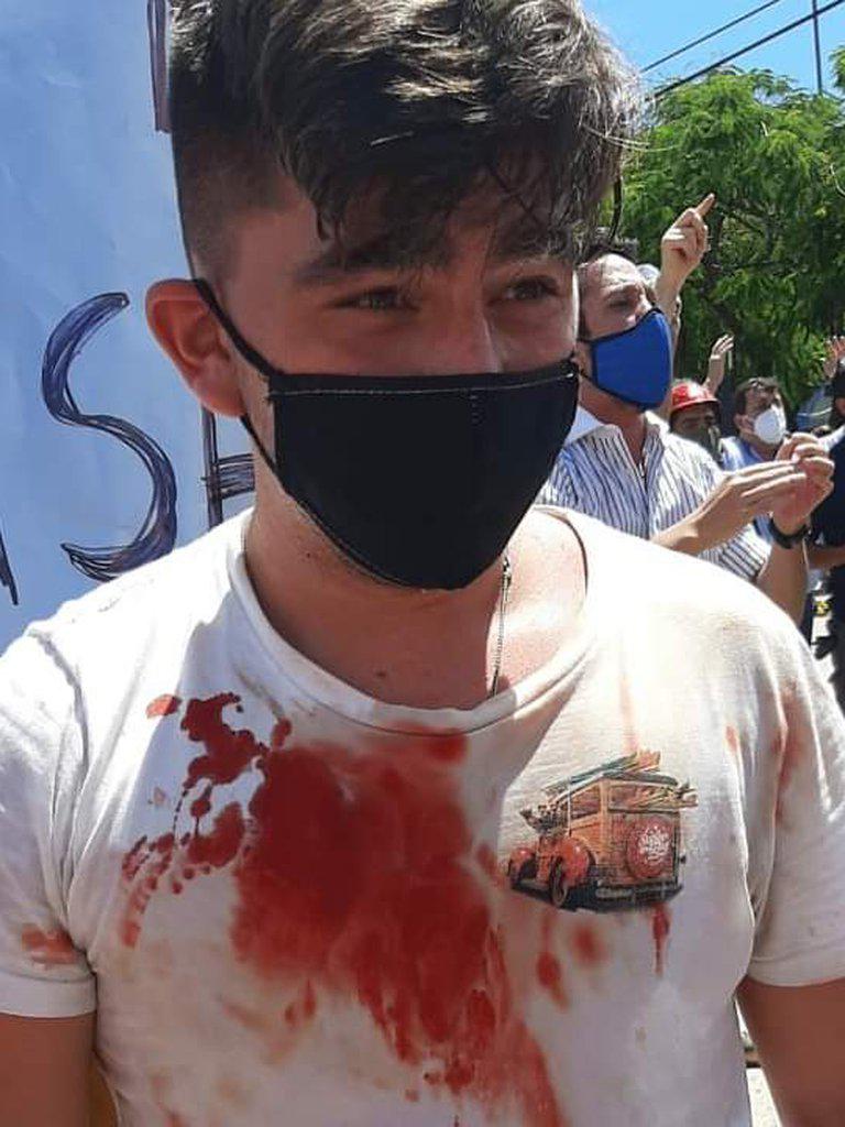 heridos en formosa 1