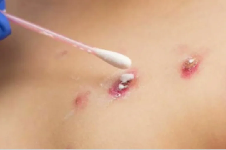 Q257S72VIZBHVPIVDFTSBIATPU