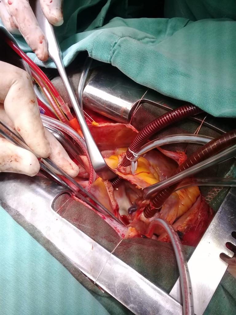 82faacd2-feea-4ffd-a5dc-e6ca88f5219a