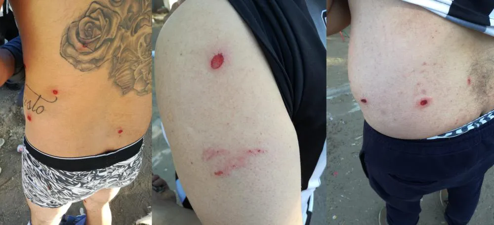 incidentes futbol Toay 2