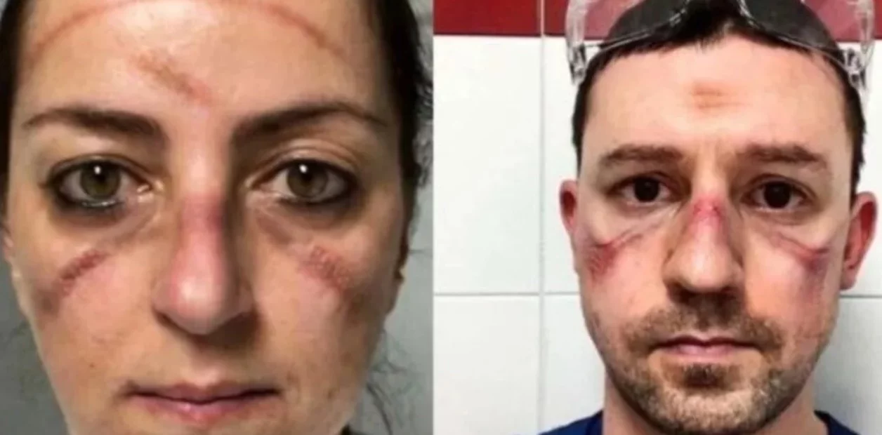 marcas rostro medicos