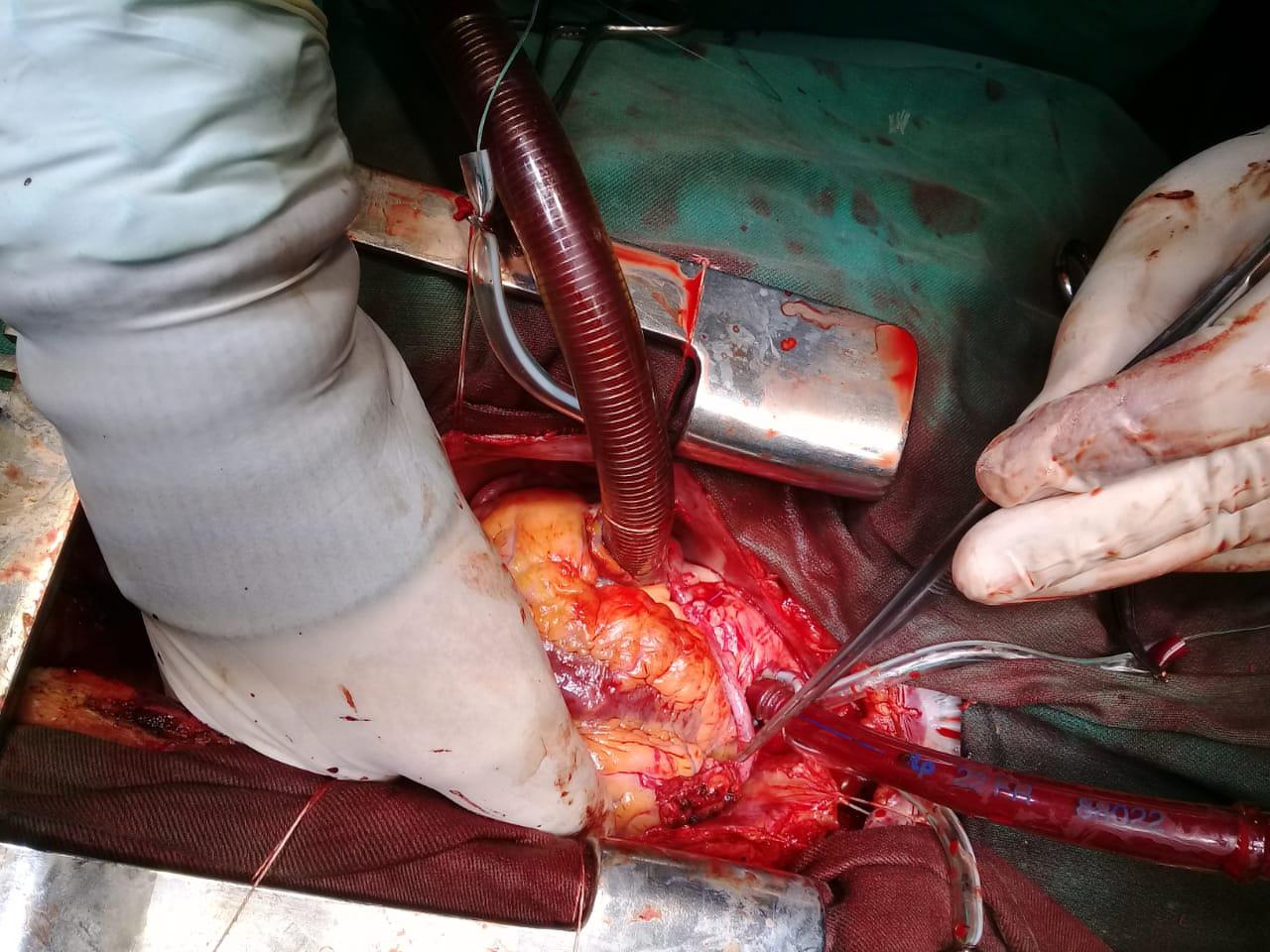 e91a4011-8f1b-4830-b0d1-af6012d56f7c