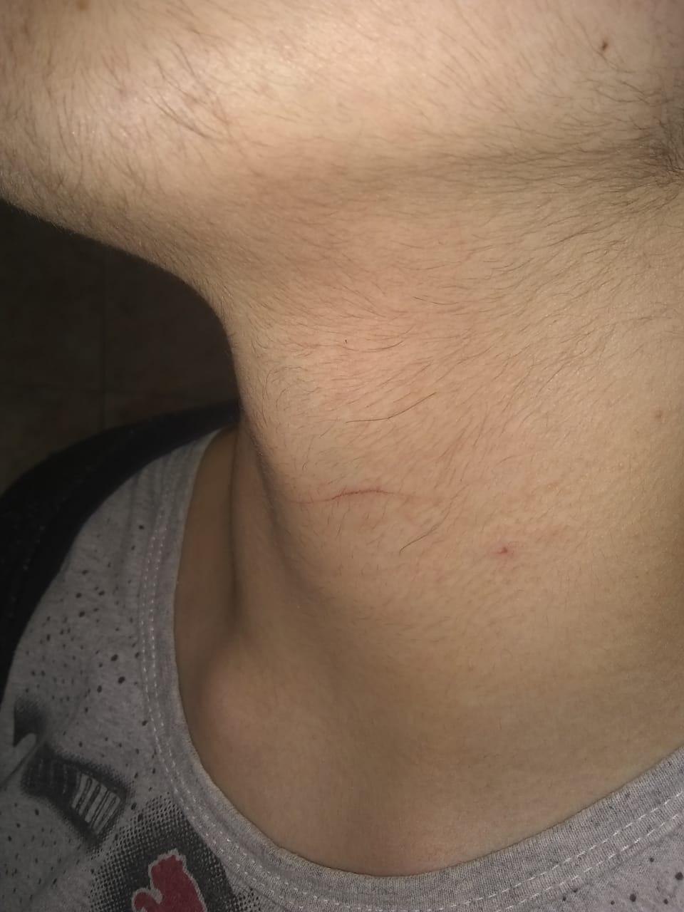 Migeul Cuchillo cuello