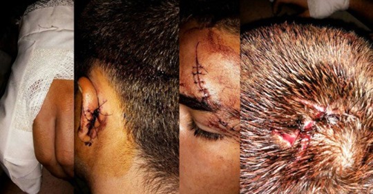 Hombre agredido