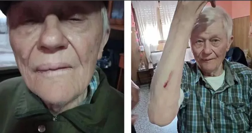 Jubilado golpeado en Winifreda