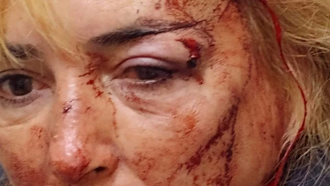 mujer golpeada en un bar
