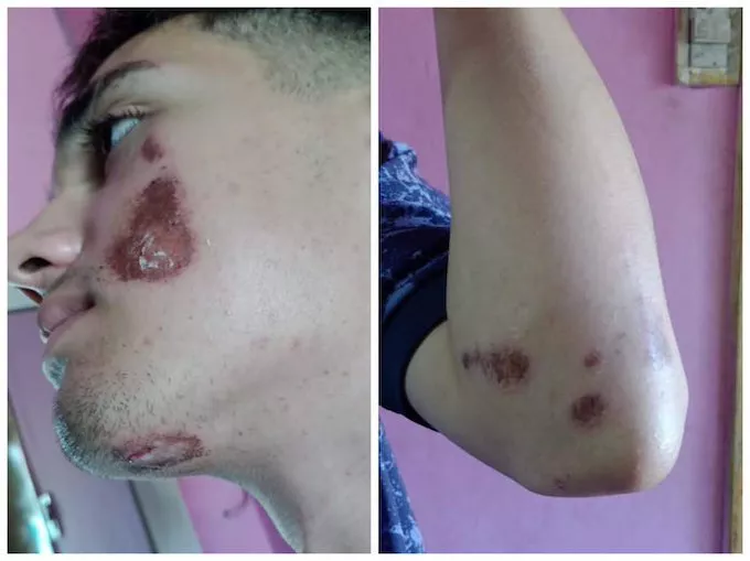 golpeado cañuelas