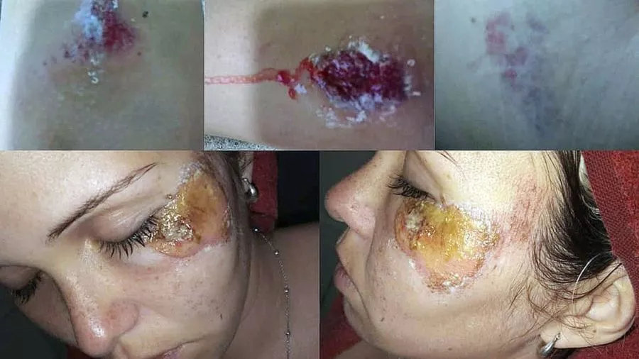 violencia de género serrano