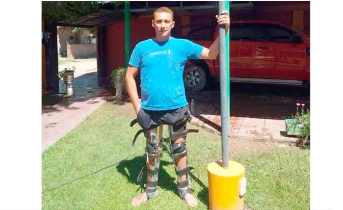 Sergio garcia protesis captura