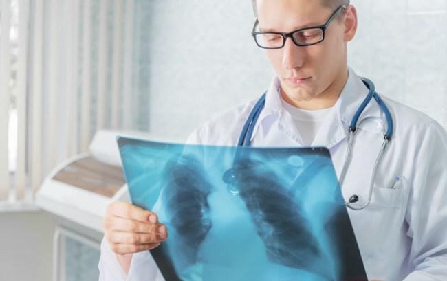 TUBERCULOSIS-PLACA-PULMONAR-DOCTOR