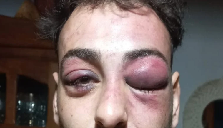 lautaro golpiza