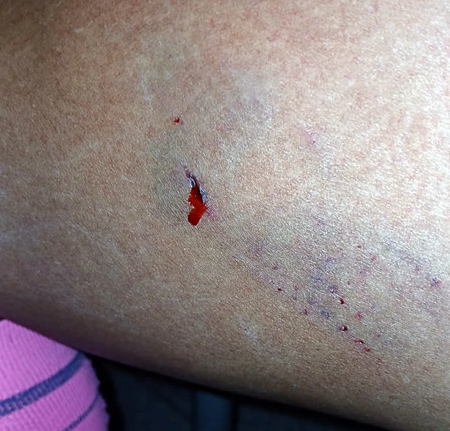 mordida perros 2