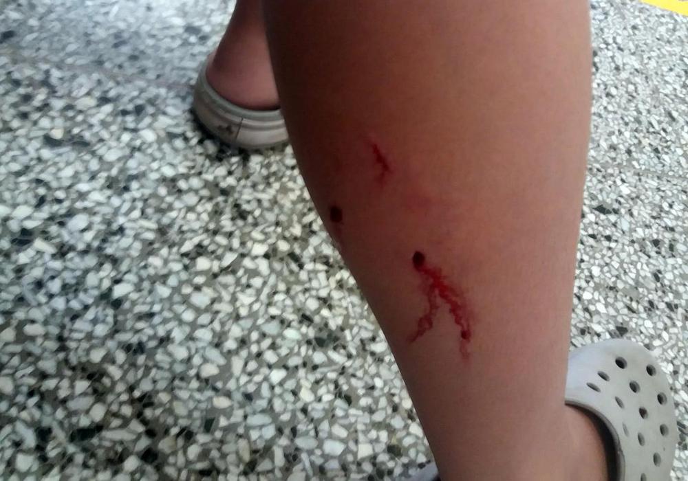 mordedura perro 2
