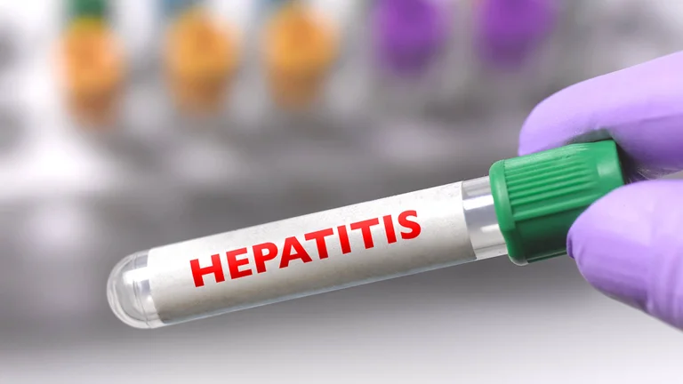 HEPATITS