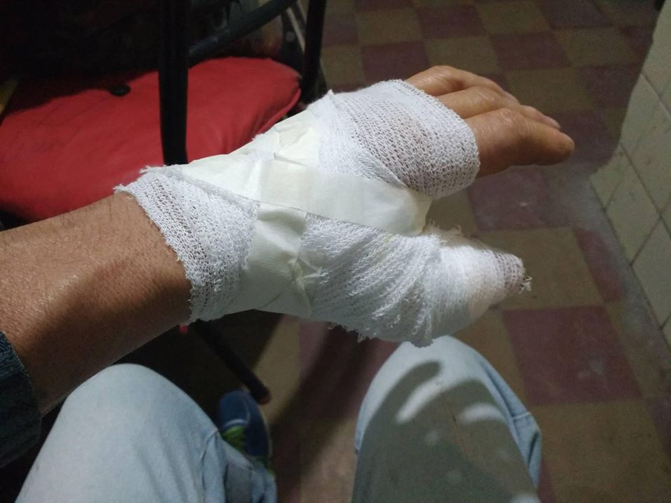 RECOLECTOR DE RESIDUOS LESIONADO