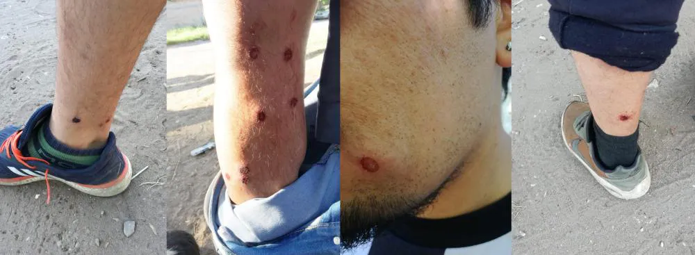 incidentes futbol Toay 3