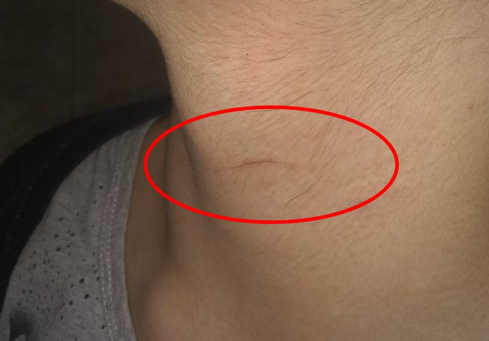 Migeul Cuchillo cuello pp