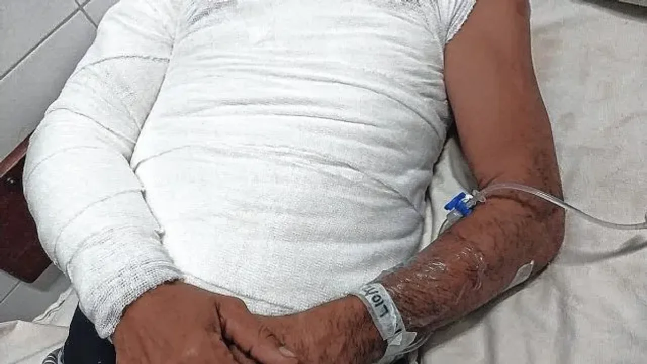 QUEMADO