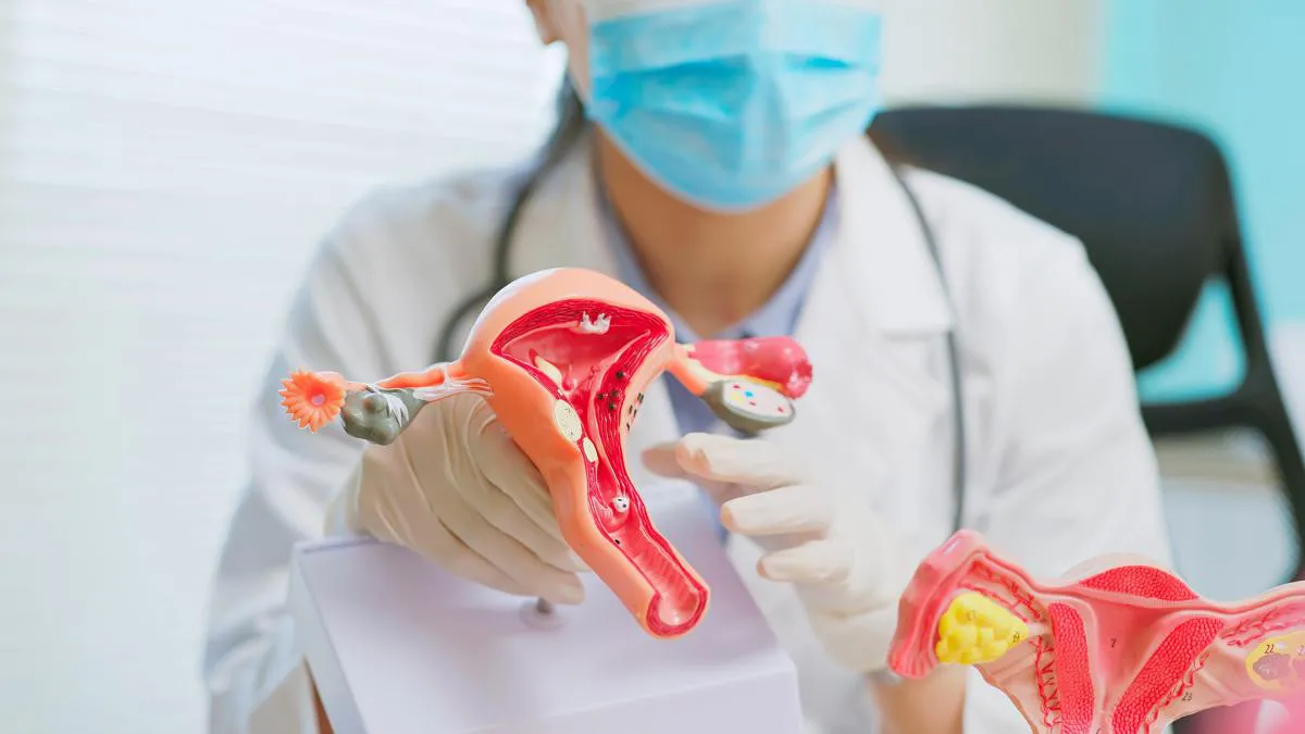 CANCER ENDOMETRIO