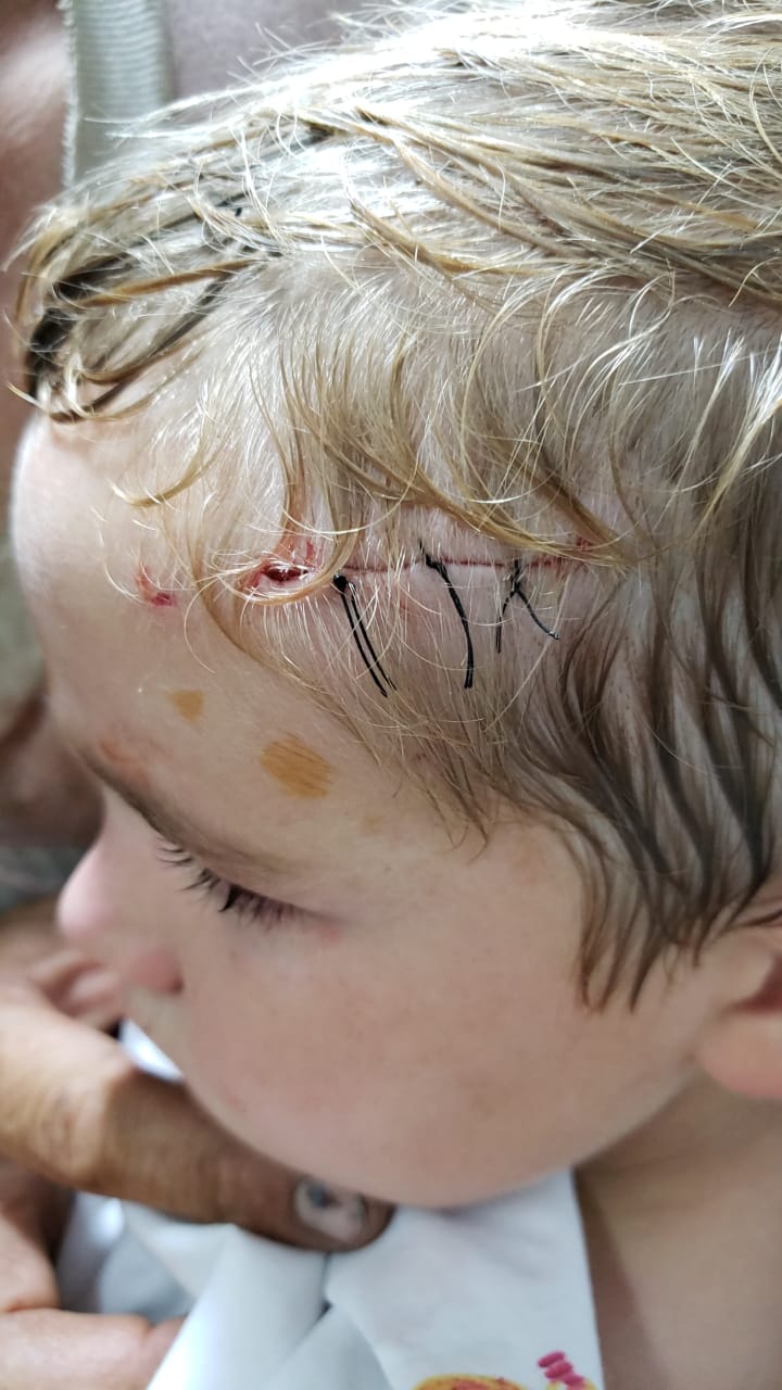 niño mordida perro Embajador